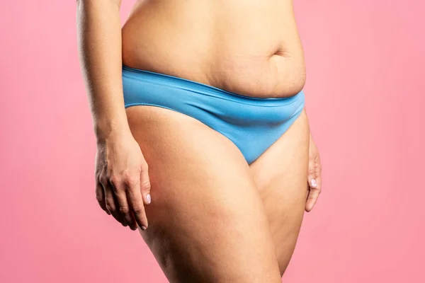 Tummy tuck, flabby skin on a fat belly, plastic surgery concept on pink background