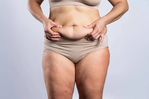 Tummy Tuck Slapp Hud Fet Mage Plast Kirurgi Koncept Grå — Stockfoto