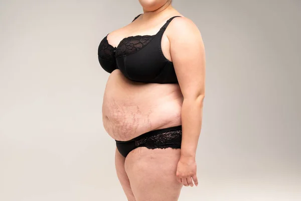 Tlustá Žena Černém Prádle Nadváha Ženské Tělo Šedém Pozadí Plastická — Stock fotografie