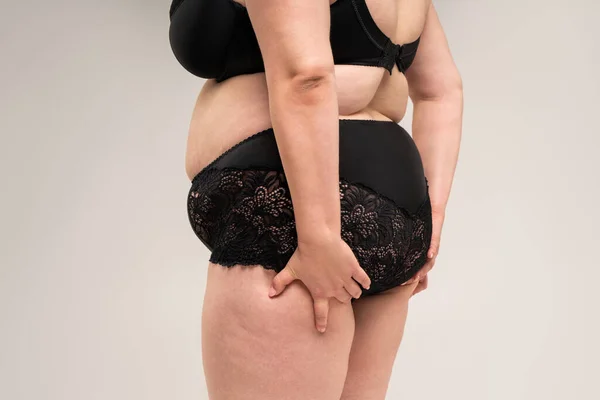 Надмірна Вага Жінки Жирними Стегнами Сідницями Ожиріння Жіночого Тіла Сірому — стокове фото