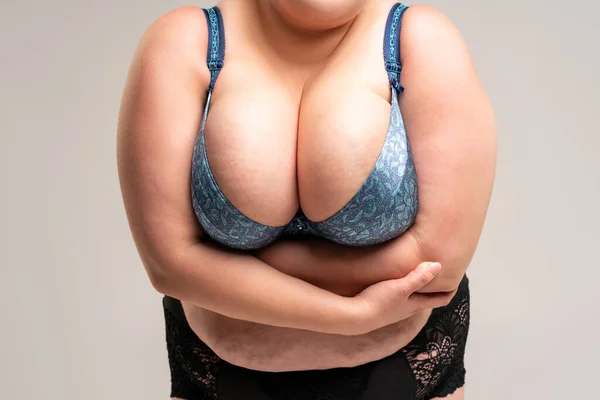 Seios Muito Grandes Sutiã Azul Corpo Feminino Obesidade Fundo Cinza — Fotografia de Stock