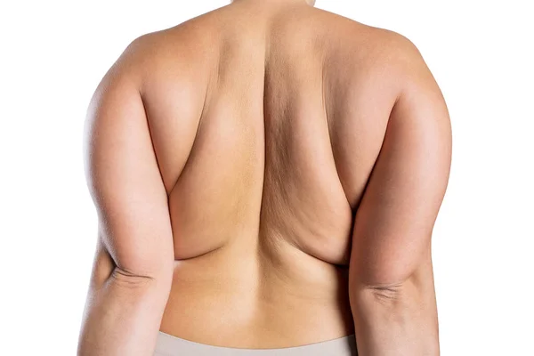 Надмірна Вага Жінки Жирною Спиною Ожиріння Жіночого Тіла Ізольовані Білому — стокове фото