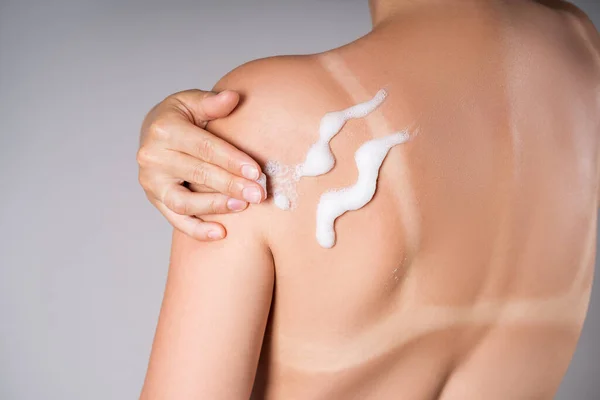 Tanned Woman Applies Sunscreen Her Back Sunburn Marks Body Studio — Stock Photo, Image