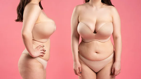 Tummy tuck, flabby skin on a fat belly, plastic surgery concept on pink background, collage of two photos