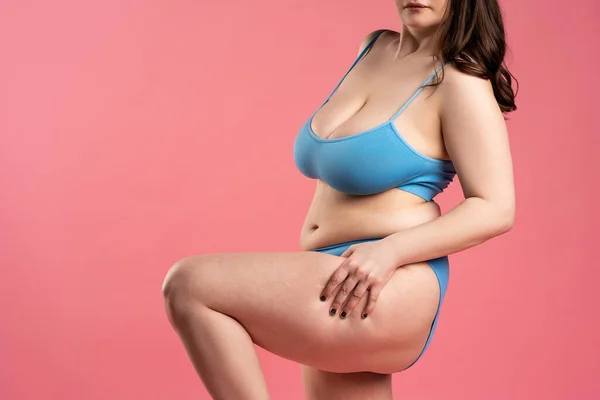 Mulher Gorda Com Celulite Nas Coxas Roupa Interior Azul Sobre — Fotografia de Stock