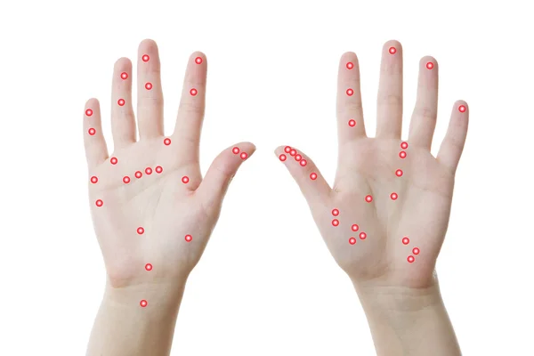 Eller, acupressure palms kadar izole — Stok fotoğraf