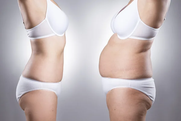 前に、と減量後の女性の体 ストック写真