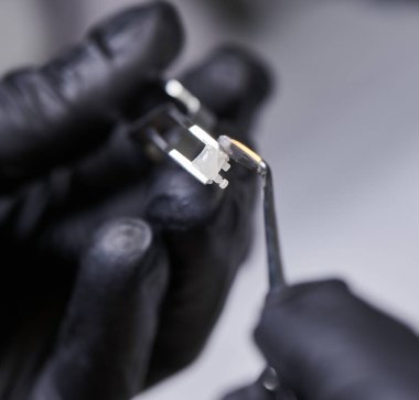 Ortodontiste siyah steril eldiven giydirip ortodontiye diş teli takmak için paslanmaz çelik diş aletine yapıştırıcı sürün. Stomatoloji kavramı