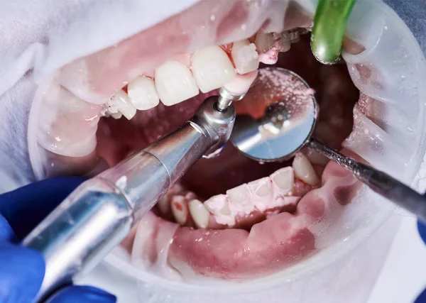 Close up view on cleaning teeth of patient with cheek retractor in mouth and brackets on teeth with a help of tooth brush, mechanical brush, mirror and saliva ejector. Dental procedures concept