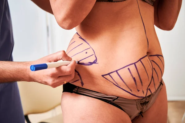 Mujer gorda dibujo fotos de stock, de Mujer gorda royalties | Depositphotos