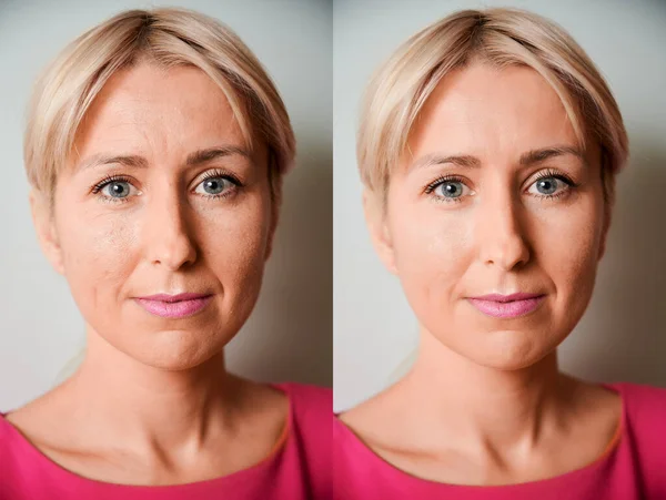 Conjunto Dois Retratos Mesma Mulher Antes Outro Depois Tratamento — Fotografia de Stock