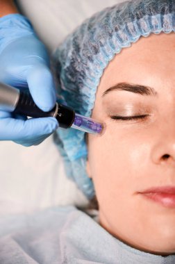 Cilt bakımı sırasında dermapen kullanarak steril eldiven takan kozmetoloji uzmanını kapatın. Sağlık merkezinde yüz bakımı gören genç bir kadın. Güzellik anlayışı, cilt bakımı, yaşlanmayı önleme prosedürü.
