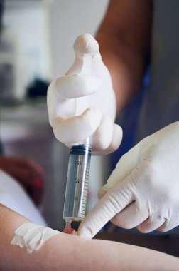 Steril eldivenlerle tıp işçilerinin ellerini kapatın. Anestezi için şırınga verin. Doktor ameliyattan önce anestezi ilacı enjekte ederken hastanın koluna iğne sokuyor..