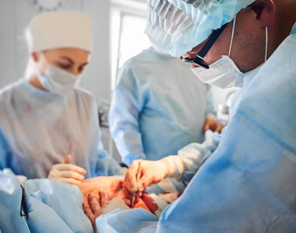 Trabalhadores Médicos Ternos Cirúrgicos Azuis Realizando Operação Cirúrgica Sala Cirurgia — Fotografia de Stock