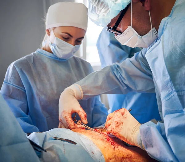 Närbild Sjukvårdspersonal Kirurgiska Kostymer Som Utför Magkirurgi Operationssalen Manlig Plastikkirurg — Stockfoto