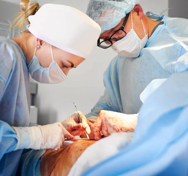 病院で腹腔鏡手術を行う医師 手術室で腹部形成外科を行う男性の整形外科医に焦点を当てます おなかタックと美容整形の概念 — ストック写真