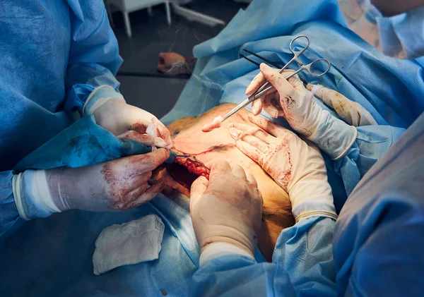 대부분의 의료진들이 수술실에서 이상성 수술을 있습니다 성형외과 의사와 조수가 환자의 — 스톡 사진