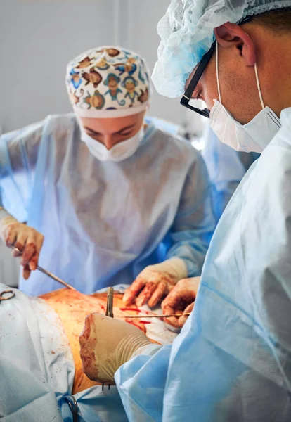 Doctors performing abdominoplasty surgery in clinic. Focus on male plastic surgeon conducting abdominal plastic surgery in operating room. Concept of medicine, tummy tuck, cosmetic surgery