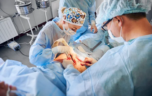 外科手術のスーツを着た医療従事者が整形手術を行う 患者の腹部から余分な脂肪を除去しながら 整形外科医や医療面マスクや滅菌手袋を身に着けているアシスタント — ストック写真