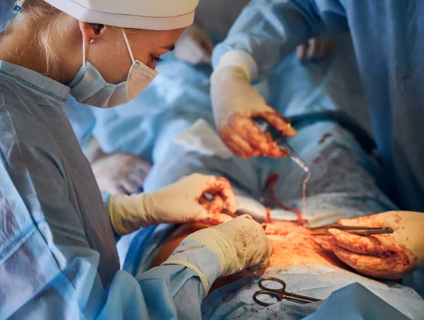 종양이 봉합을 장갑을 의료진을 했습니다 성형외과 의사가 수술을 있어요 무절제 — 스톡 사진