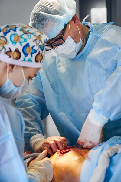 手術室でおなかタック手術を行う手術スーツの医療従事者 患者腹部から余分な脂肪を除去しながら 整形外科医や助手は顔マスクや滅菌手袋を身に着けています — ストック写真