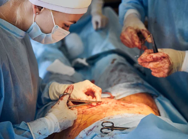 Zamknąć Zespół Medyczny Sterylnych Rękawiczkach Zakładając Szwy Operacji Chirurgicznej Plastycznej — Zdjęcie stockowe