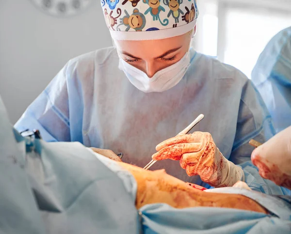 Chirurgin Mit Medizinischer Maske Die Operationssaal Eine Bauchkorrektur Durchführt Junge — Stockfoto