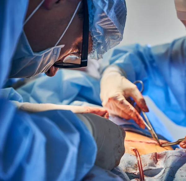 장갑을 수술실에서 움직여 수술을 마무리하고 있습니다 성형외과 의사와 보조로 수술을 — 스톡 사진