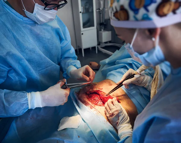 Medicinsk Personal Sterila Handskar Som Utför Plastikkirurgi Läkare Som Bär — Stockfoto