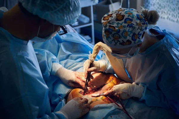 Top view of doctors performing abdominoplasty surgery in clinic. Male plastic surgeon and female assistant doing abdominal plastic surgery in operating room. Concept of tummy tuck and cosmetic surgery