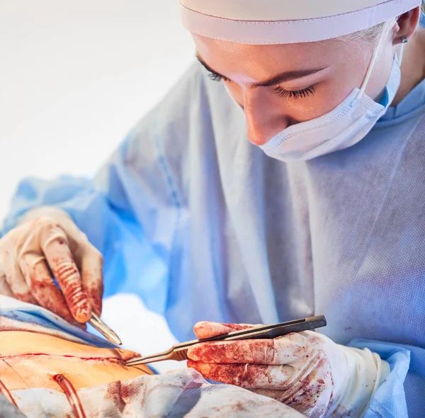 Close Cirurgiã Jovem Colocando Suturas Após Cirurgia Barriga Mulher Médica — Fotografia de Stock