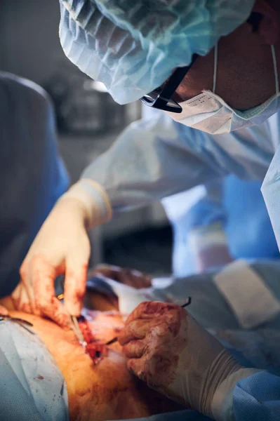 Male plastic surgeon in sterile gloves doing tummy tuck surgery in operating room. Doctor wearing medical face mask and surgical uniform while performing abdominal plastic surgery in clinic.