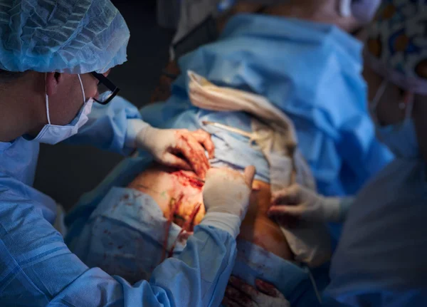 Doctor in medical face mask performing abdominal plastic surgery in operating room, placing sutures after tummy tuck surgery. Focus on surgeon face. Concept of abdominoplasty and cosmetic surgery.