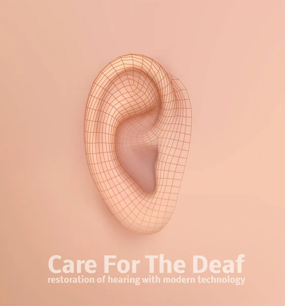 Vektor Menschliches Ohr Hörbehandlung Plastische Chirurgie Implantation — Stockvektor