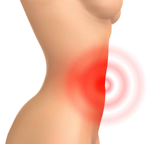 Vector Female Body White Background Abdominal Pain — Stock Vector