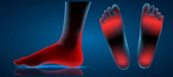 Vektor Kaki Manusia Biru Kontur Dan Titik Merah Rasa Sakit - Stok Vektor