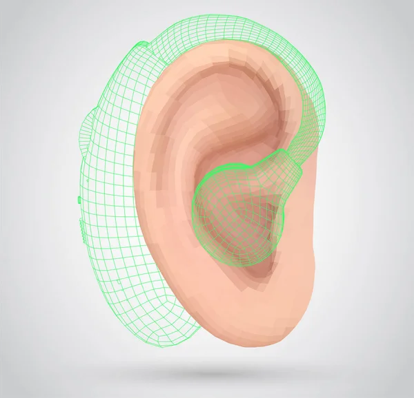 Vector Ouvido Humano Tratamento Auditivo Cirurgia Plástica Implantação —  Vetores de Stock