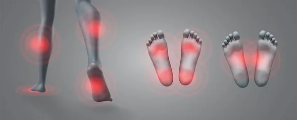 Σύνολο Διανυσματικών Ποδιών Κόκκινες Κηλίδες Πόνου Γκρι Φόντο — Διανυσματικό Αρχείο