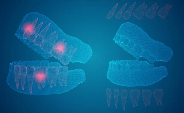 Mandíbula Humana Layout Vetorial Medicina Saúde Dor Nos Dentes —  Vetores de Stock