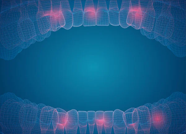 Lidská Čelist Vektorové Uspořádání Léky Zdraví Bolest Zubů — Stockový vektor