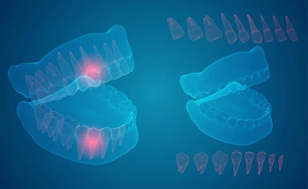 Lidská Čelist Vektorové Uspořádání Léky Zdraví Bolest Zubů — Stockový vektor