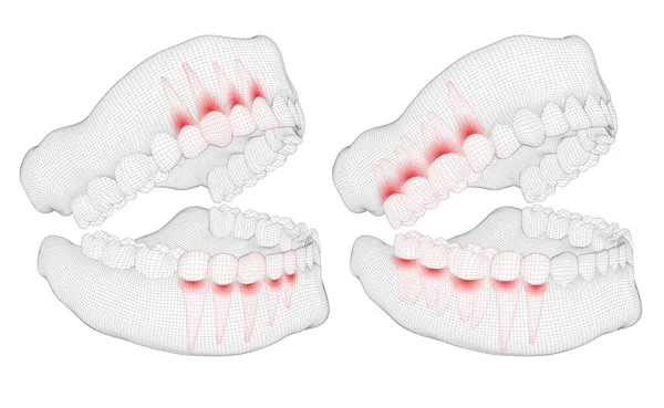 Mandíbula Humana Layout Vetorial Medicina Saúde Dor Nos Dentes —  Vetores de Stock