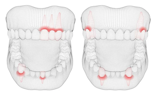 Lidská Čelist Vektorové Uspořádání Léky Zdraví Bolest Zubů — Stockový vektor