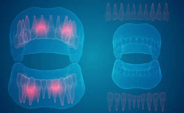 Lidská Čelist Vektorové Uspořádání Léky Zdraví Bolest Zubů — Stockový vektor