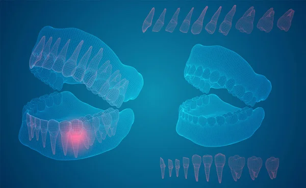 Mandíbula Humana Layout Vetorial Medicina Saúde Dor Nos Dentes —  Vetores de Stock