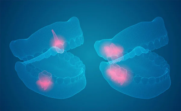 Mandíbula Humana Diseño Vectores Medicina Salud Dolor Dientes — Vector de stock