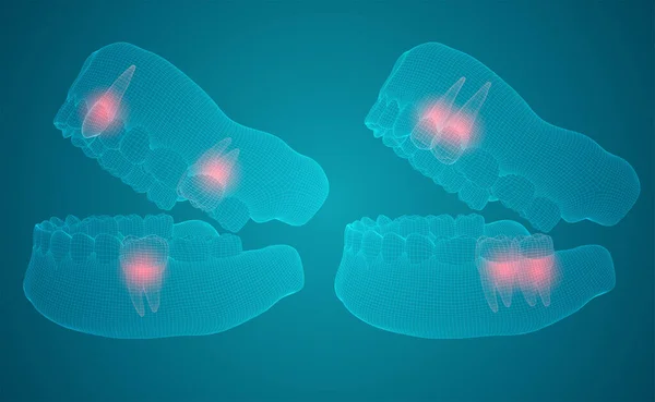 Mandíbula Humana Layout Vetorial Medicina Saúde Dor Nos Dentes —  Vetores de Stock