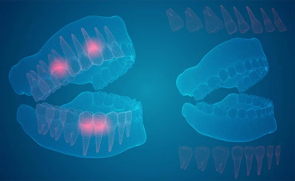 人类的下巴 3D矢量布局 药物与健康 疼痛的牙齿 — 图库矢量图片