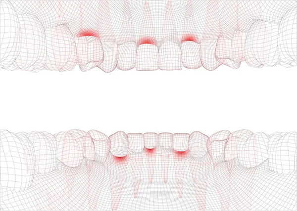 人类的下巴 3D矢量布局 药物与健康 疼痛的牙齿 — 图库矢量图片