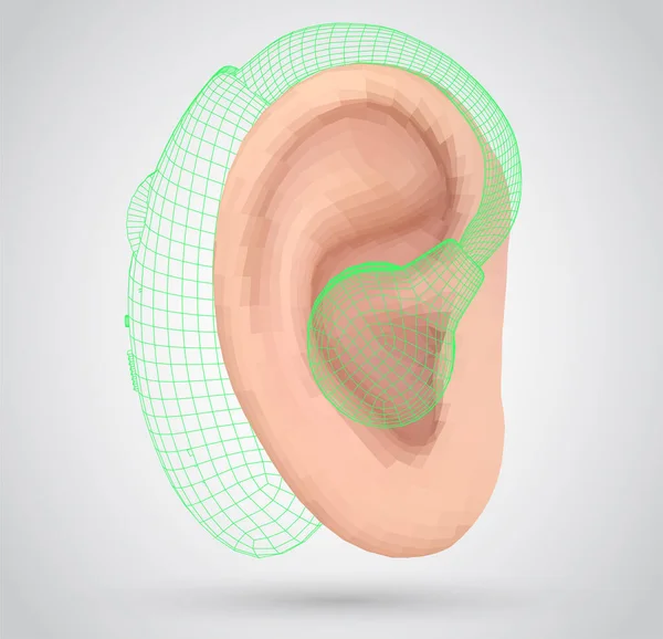 Vector Oído Humano Tratamiento Auditivo Cirugía Plástica Implantación — Vector de stock